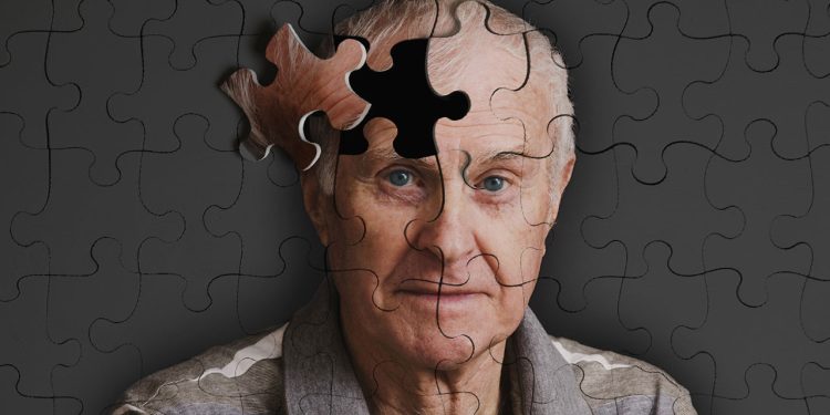 Alzheimer kol geziyor: Tek belirtisi unutkanlık değilmiş!