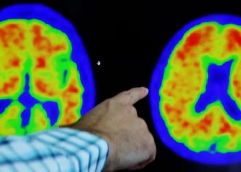 Araştırma: Alzheimer'a karşı yeni umut Viagra olabilir