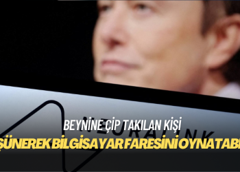 Beynine çip takılan kişi düşünerek bilgisayar faresini oynatabildi