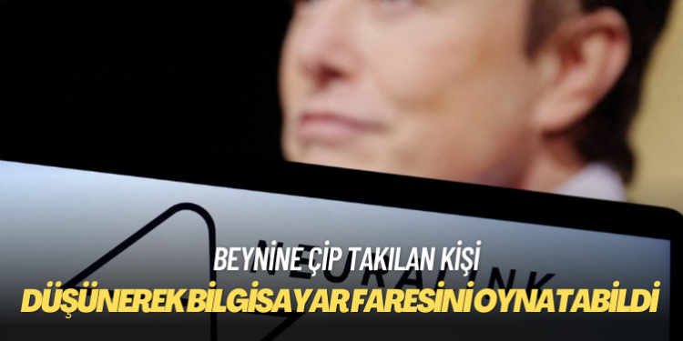 Beynine çip takılan kişi düşünerek bilgisayar faresini oynatabildi