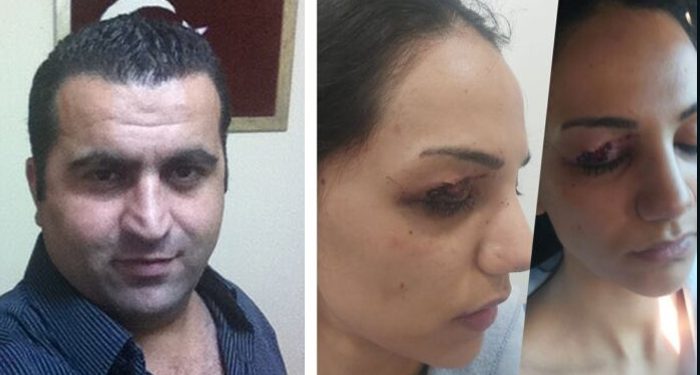 Emniyet müdürü dehşeti; meslektaşının eşine önce çıplak arama yaptırdı, sonra darp etti