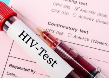 HIV dünyada düşerken Türkiye'de 4 kat arttı