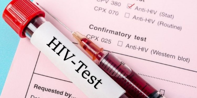 HIV dünyada düşerken Türkiye'de 4 kat arttı