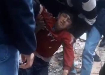 Siirt’te su kuyusuna düşen çocuk yaralandı