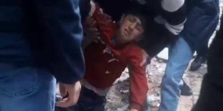 Siirt’te su kuyusuna düşen çocuk yaralandı