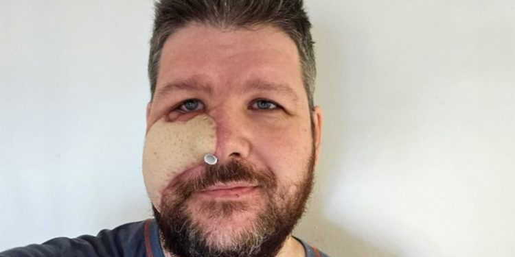 Yüzünü parçalayan ayıyı kebap yapıp yedi