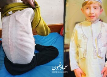 165 gündür İsrail saldırıları altındaki Gazze'de çocukların açlıkla imtihanı