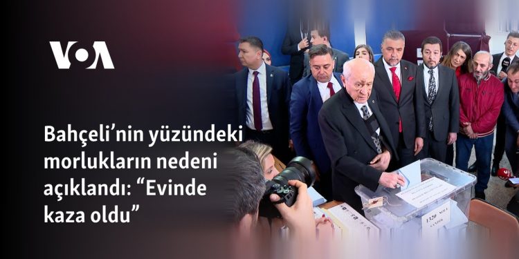 Bahçeli’nin yüzündeki morlukların nedeni açıklandı: “Evinde kaza oldu” 