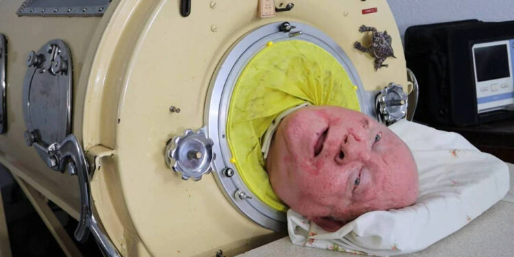 'Demir Akciğerli Adam' yaşamını yitirdi