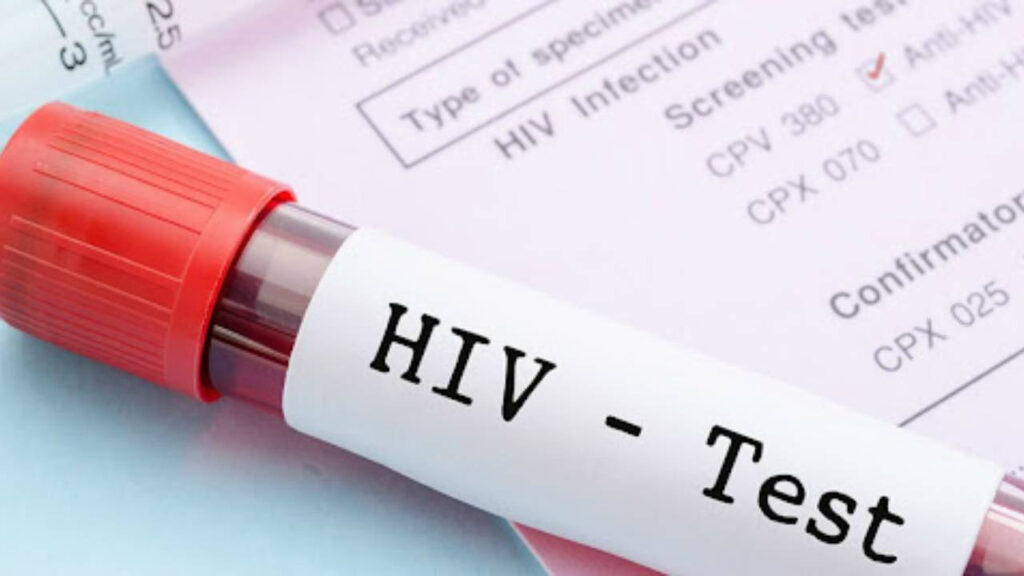 HIV tedavisinde umut vadeden araştırma: Virüs tamamen yok edilebilir