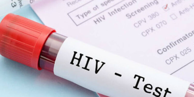 HIV tedavisinde umut vadeden araştırma: Virüs tamamen yok edilebilir