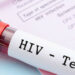 HIV tedavisinde umut vadeden araştırma: Virüs tamamen yok edilebilir