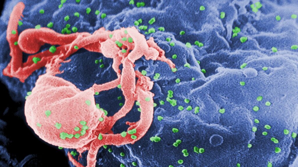 AIDS'e karşı yeni umut: HIV'i hücreden ayırma denemesi başarılı oldu