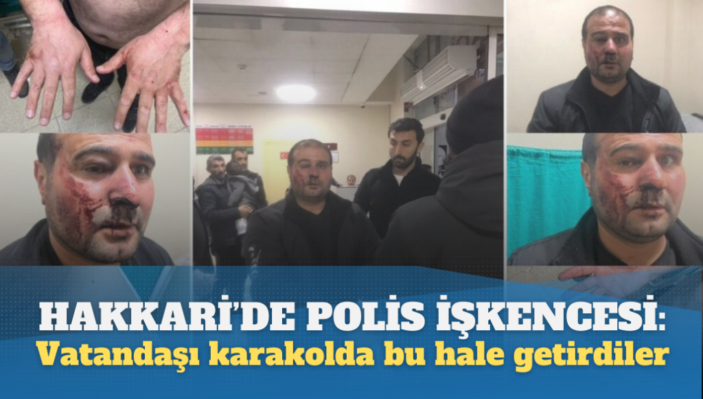 Hakkari’de polis işkencesi: Vatandaşı karakolda dövüp bu hale getirdiler