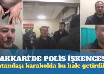 Hakkari’de polis işkencesi: Vatandaşı karakolda dövüp bu hale getirdiler