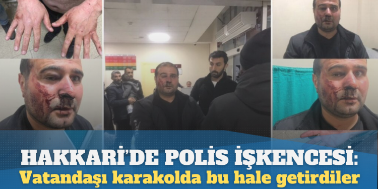 Hakkari’de polis işkencesi: Vatandaşı karakolda dövüp bu hale getirdiler
