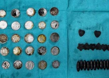 Haltercinin midesinden çıkarılanlar şoke etti: Vücudu gelişsin diye yutmuş!