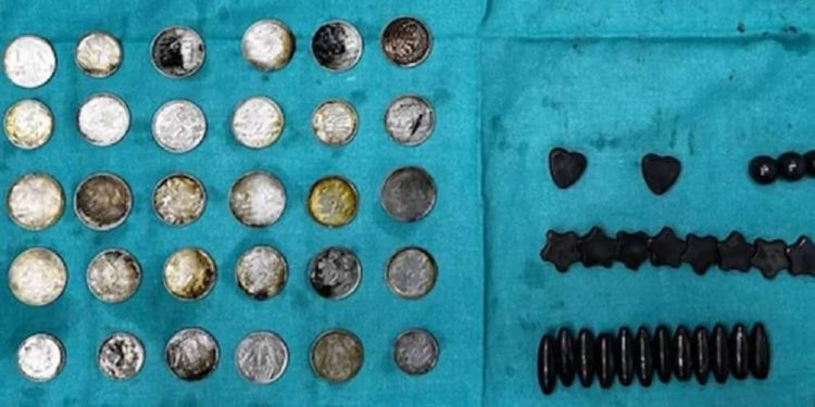 Haltercinin midesinden çıkarılanlar şoke etti: Vücudu gelişsin diye yutmuş!