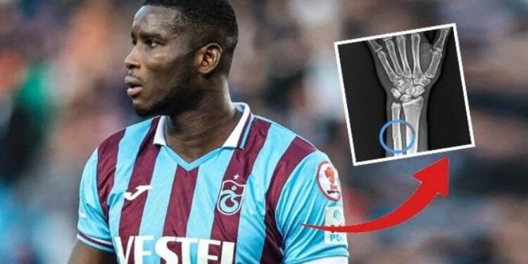 Trabzonspor’dan Onuachu tepkisi: Kırılın kolun röntgen görüntüsü paylaşıldı