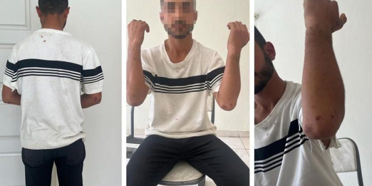 Adana’da polislerin darp ettiği 17 yaşındaki gence Çatak’tan çıkmama cezası