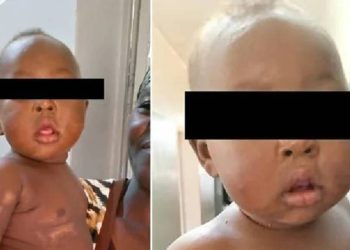 Annesinin diri diri bahçeye gömdüğü bebek kurtarıldı