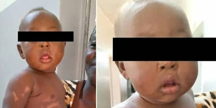 Annesinin diri diri bahçeye gömdüğü bebek kurtarıldı