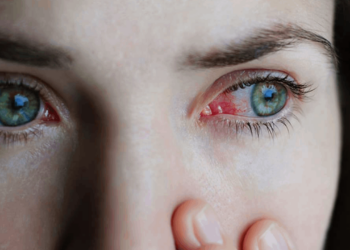 Son 3 haftada hızla yayıldı