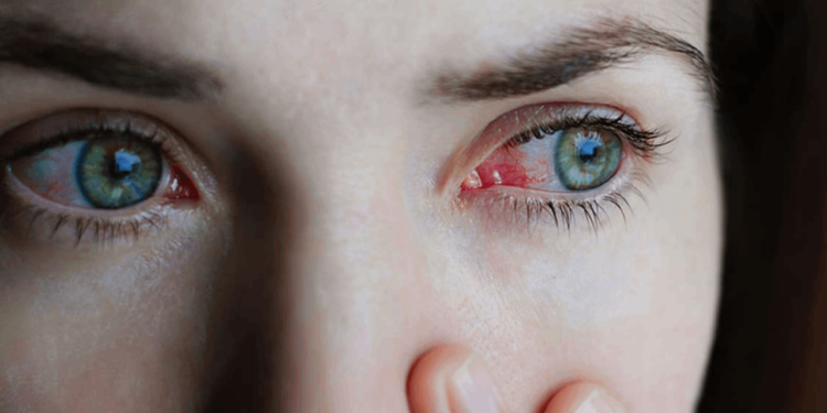 Son 3 haftada hızla yayıldı