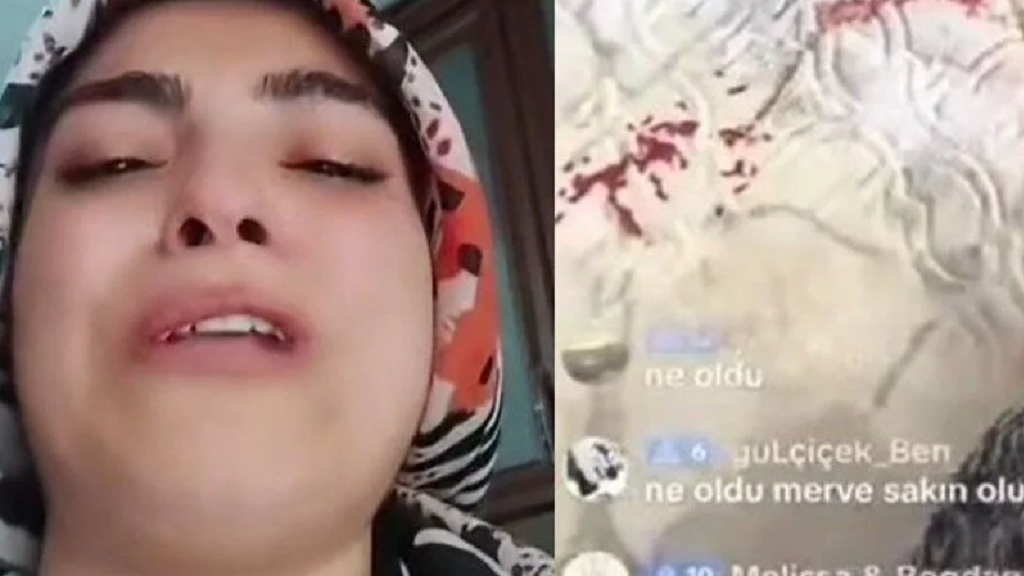 Yaralanan çocuğuyla TikTok'ta canlı yayın yaptı! O ‘anne’ gözaltına alındı