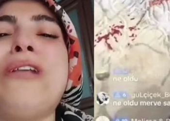 Yaralanan çocuğuyla TikTok'ta canlı yayın yaptı! O ‘anne’ gözaltına alındı