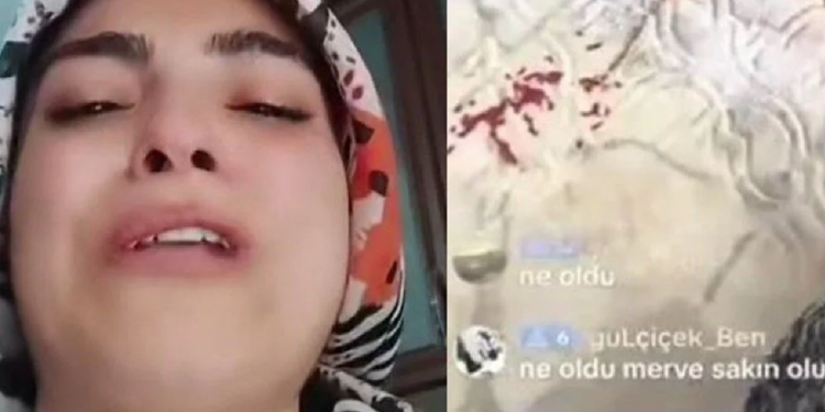 Yaralanan çocuğuyla TikTok'ta canlı yayın yaptı! O ‘anne’ gözaltına alındı