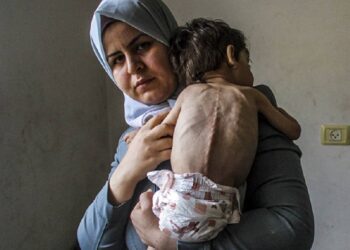 Gazze'de 50 bin çocuğun akut yetersiz beslenme nedeniyle tedaviye ihtiyacı var, 3 bin 500'ü açlıktan ölümün eşiğinde