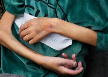 Gazze'nin kuzeyindeki hastaneye yetersiz beslenme nedeniyle getirilen çocuklar: Bir hafta içinde dördü öldü