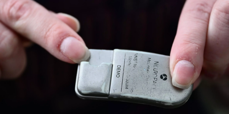 İlk kez bir çocuğun kafasına epilepsi cihazı yerleştirildi