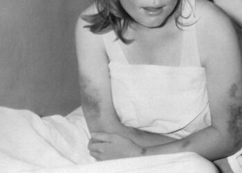 Sivas’ta Kırım Kongo Kanamalı Ateşi paniği: 3 kişi öldü