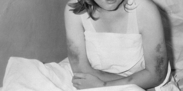 Sivas’ta Kırım Kongo Kanamalı Ateşi paniği: 3 kişi öldü