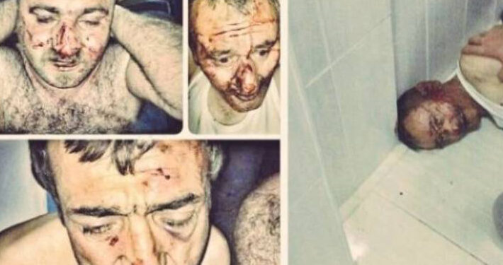 TİHV raporu: Son 10 yılda 7 bin 548 işkence başvurusu yapıldı