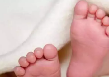 3 Aylık Bebeğin "Kuyruğu" Ameliyatla Alındı