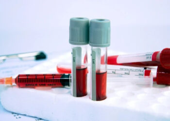 AIDS'ten 100 Kat Daha Bulaşıcı! Tedavi Edilmezse Ölümle Sonuçlanabilir...