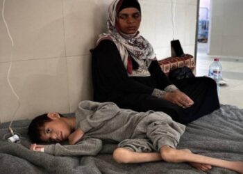 Filistinli doktor Hur: Gazze'deki hastaneler yetersiz beslenme vakalarıyla dolu