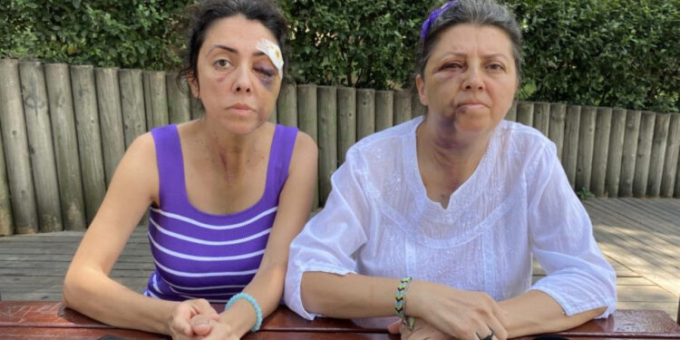 Hayvanseverlere Yönelik Şiddet Yükseliyor: İki Kız Kardeşi Ölesiye Darp Ettiler