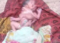 Hindistan'da 2 Yüzlü, 4 Kol ve 4 Bacaklı Bebek Doğdu
