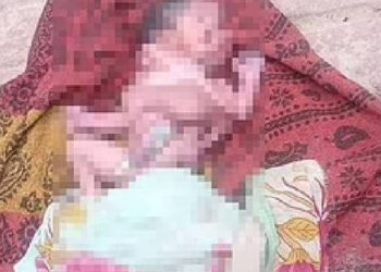 Hindistan'da 2 Yüzlü, 4 Kol ve 4 Bacaklı Bebek Doğdu