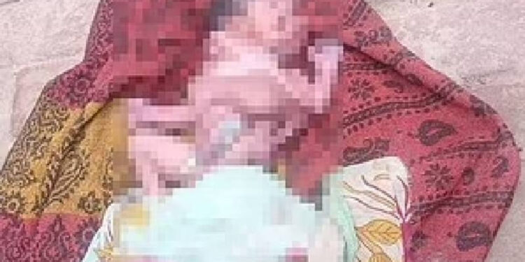 Hindistan'da 2 Yüzlü, 4 Kol ve 4 Bacaklı Bebek Doğdu