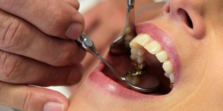 İstanbul'da 20'lik Dişini Çektiren Kadına Hepatit Bulaştı