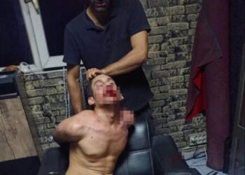 Maaşını isteyince böcek yedirdiler, elektrik verdiler, dişlerini kerpetenle çektiler