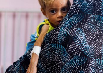 'Netanyahu'dan kısasa kısas': Golan'da patlamada 12 çocuğun ölmesi üzerine Gazze'den 150 yaralı çocuğun BAE'ye naklini durdurdu