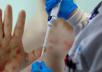 Şimdiye Kadarki En Tehlikeli Varyant! Salgın Patlak Verdi, Binlerce Vaka, Yüzlerce Ölü Var