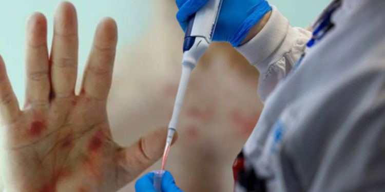 Şimdiye Kadarki En Tehlikeli Varyant! Salgın Patlak Verdi, Binlerce Vaka, Yüzlerce Ölü Var