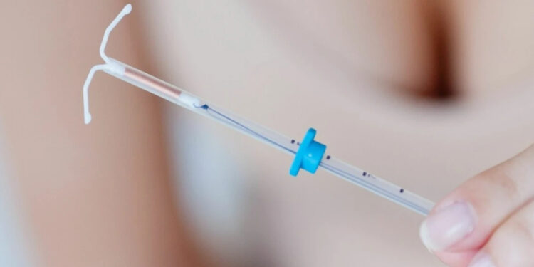 Taktırdığı Spiral Kalın Bağırsağında Bulundu